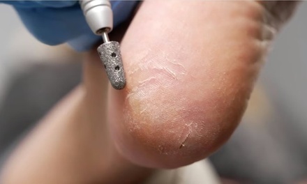 Short Overlay Set; Merchant may collect additional fees - Polish perfectionist