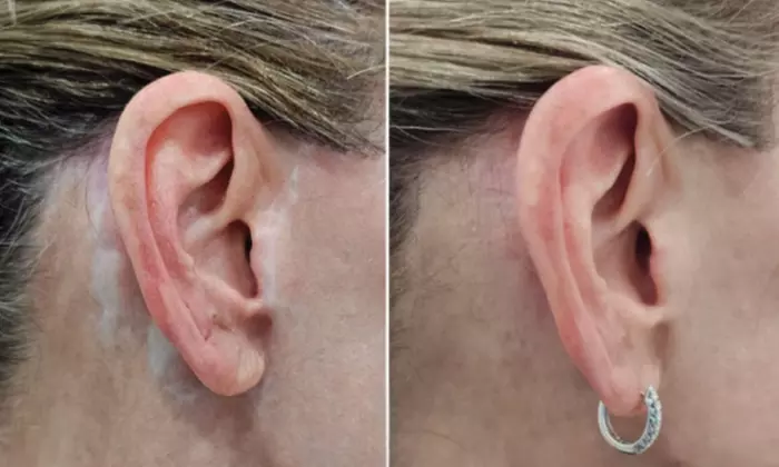 Up to 73% Off on Permanent Makeup at The Camo Clinic