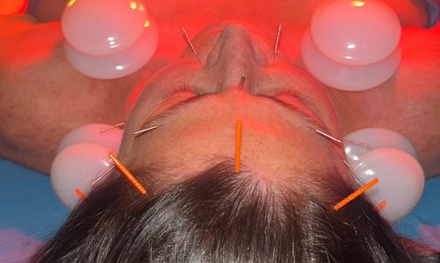 Initial Consult plus One Acupuncture Treatment - Earth Medicine and TCM Bodywork