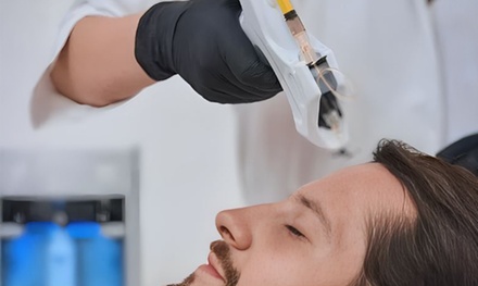 Scalp Needling  and Korean Serum  - One Session - Glow Matrix