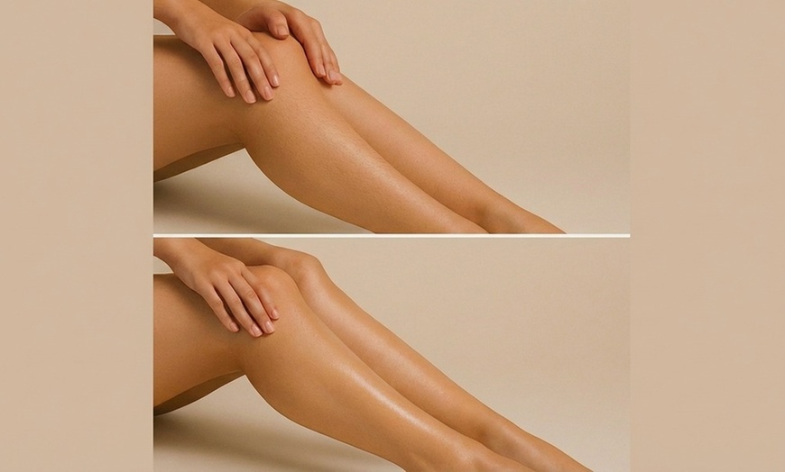 Image 2: 6 Laser Hair Removal Sessions One Small, Medium, or Large Area