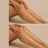 Image 2: 6 Laser Hair Removal Sessions One Small, Medium, or Large Area