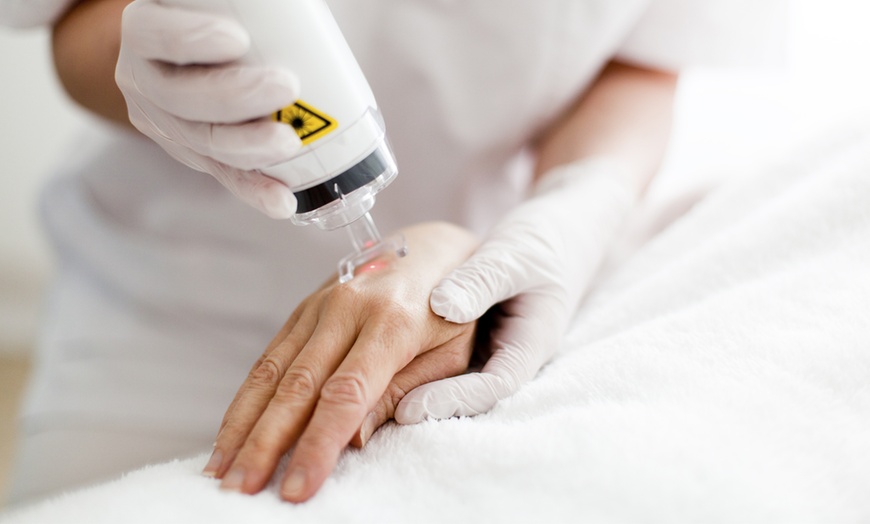 Image 1: 3 o 6 sesiones de eliminación de tatuajes con láser 