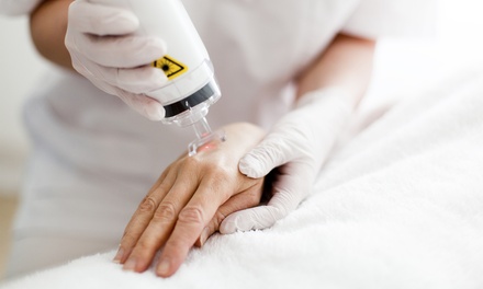 3 sesiones de eliminación de tatuajes con láser - hasta 25 cm² - Curated by AC Medicina Estetica