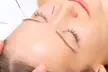 Achieve Wellness with Body cupping, Full Face Cosmetic /3 Session Package Acupuncture (Up to 33% Off)  - Second Medium