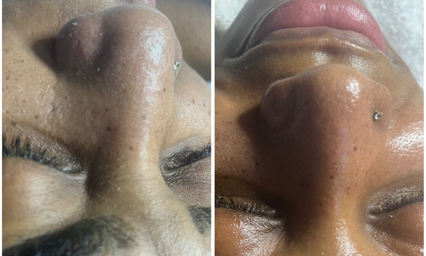Image 3: Soin du visage hydratant, anti-âge ou coup d'éclat chez Mybodyfull