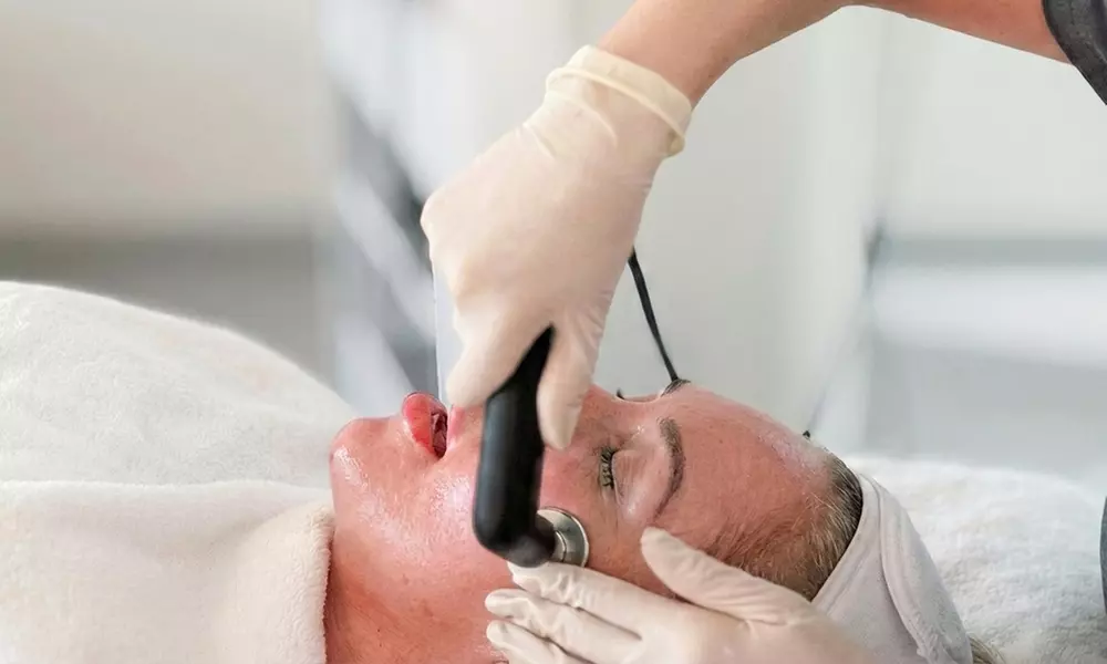 Revitalize Your Skin with One, Three or Five Microdermabrasion Treatments @Klinik Ka Aesthetic (Up to 65%Off) - Primary Image