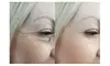 Xeomin Special: 20 or 40 Units at Collective Aesthetics (Up To 22% Off)