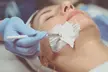 Up to 67% Off on Micro-Needling at Euro glow facial salon - Second Medium