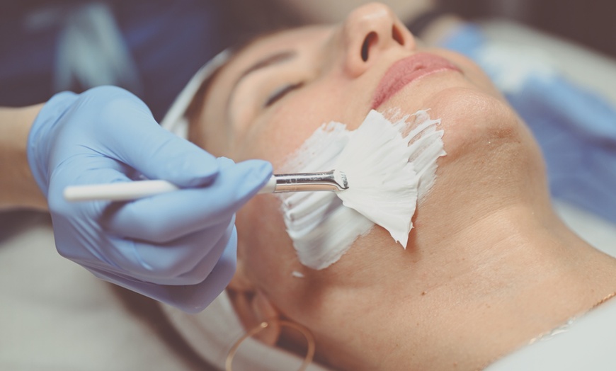 Image 1: One, Two, Three or Five Micro Needling Sessions 