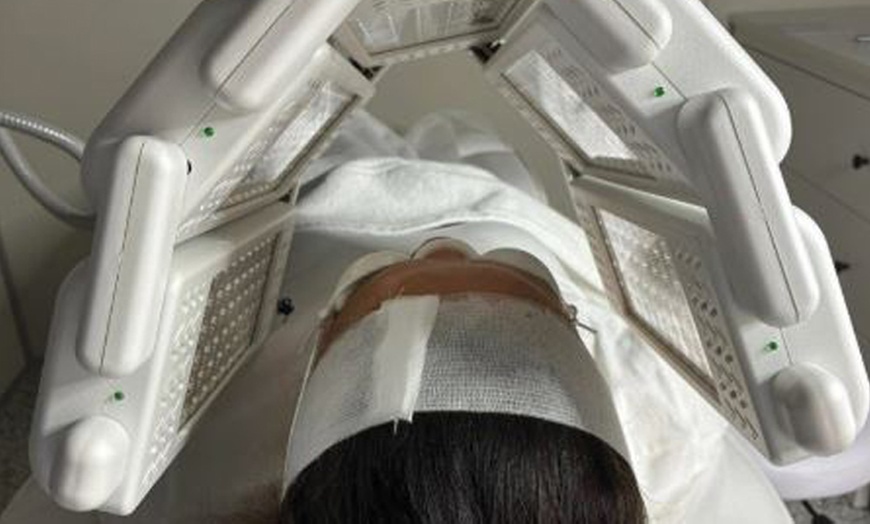 Image 2: 1 or 3 Sessions of RF Skin Tightening on Abdomen, Hips, Face & More 