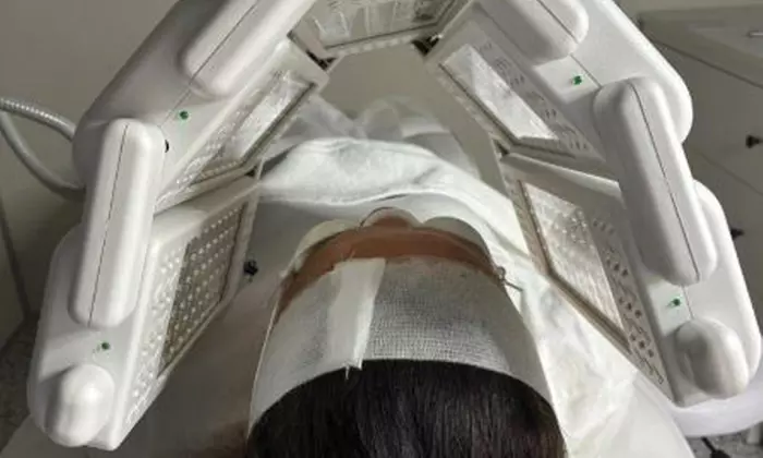 1 or 3 Sessions of RF Skin Tightening on Abdomen, Hips, Face & More