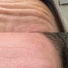 Image 3: Get a Youthful Glow with 20, 40, or 60 Units of Daxxify