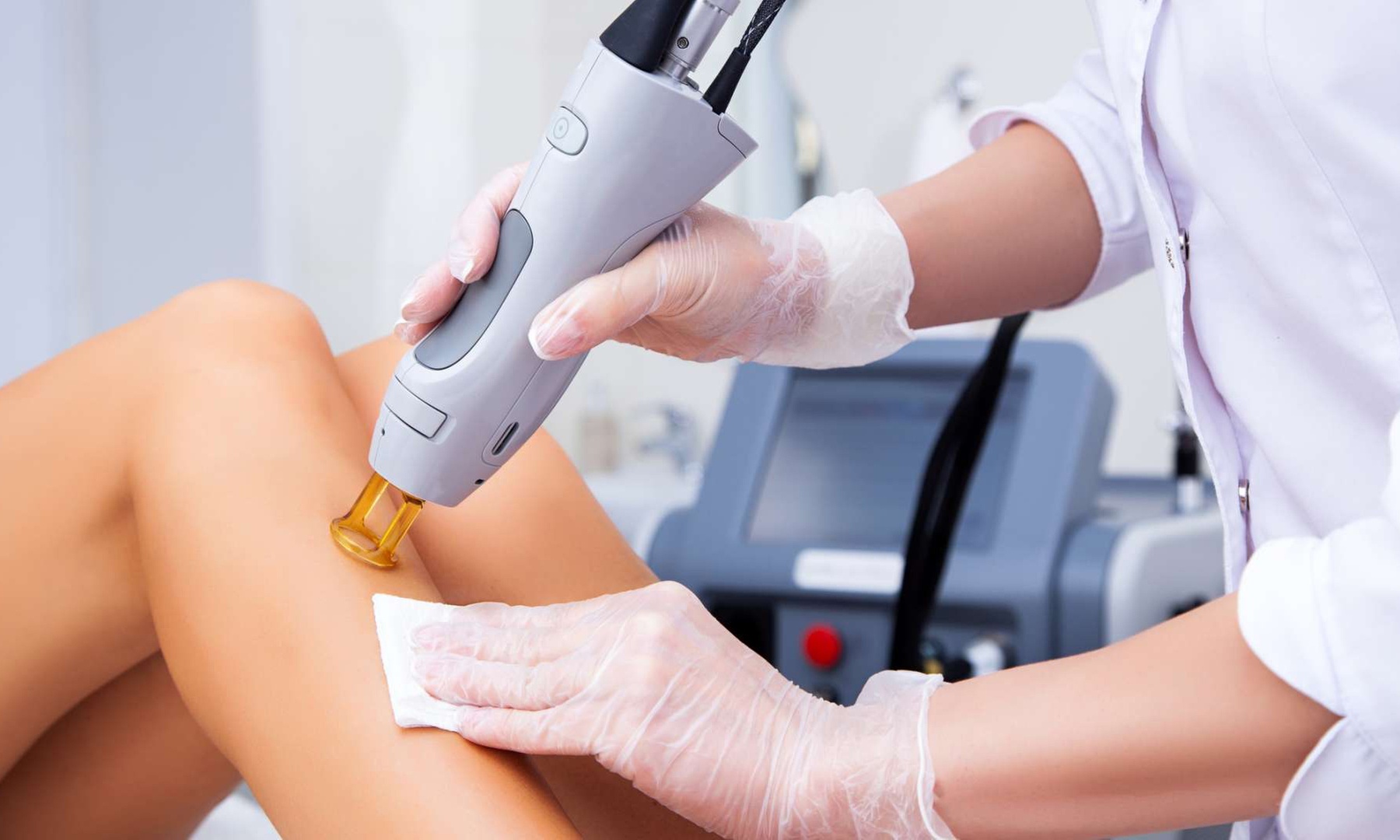 Experience Smooth Skin with Brazilian Laser Hair Removal by Candela