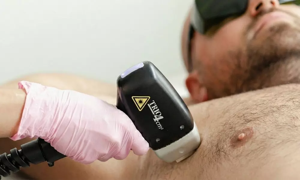 Smooth Skin Awaits: Full Body or Full Face Laser Hair Removal at LaserMe Aesthetics (Up to 50% Off) - Image 2