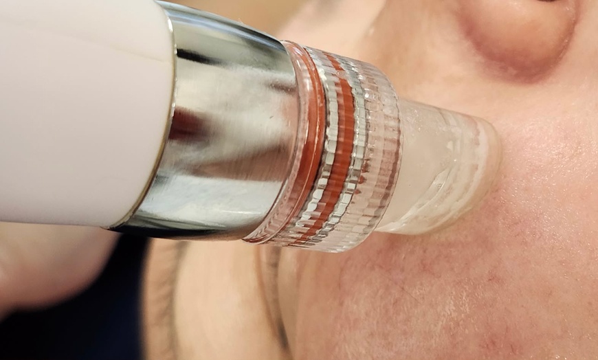 Image 5: Revitalize with 1, 2 Hydrafacial Diamond Treatment