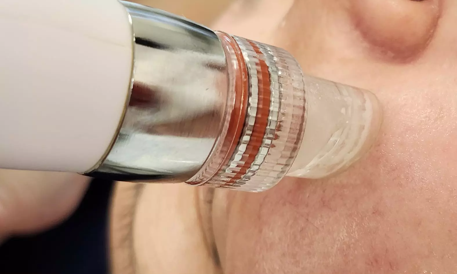 Revitalize with 1, 2 Hydrafacial Diamond Treatment