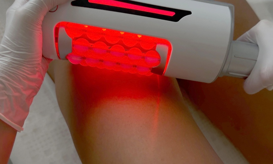 Image 3: Transform with 1 or 3 Session Cellulite Reduction & Stomach Tightening