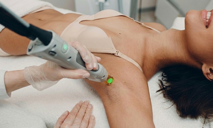 Image 3: 3 or 6 Candela Laser Hair Removal Sessions for Different Areas