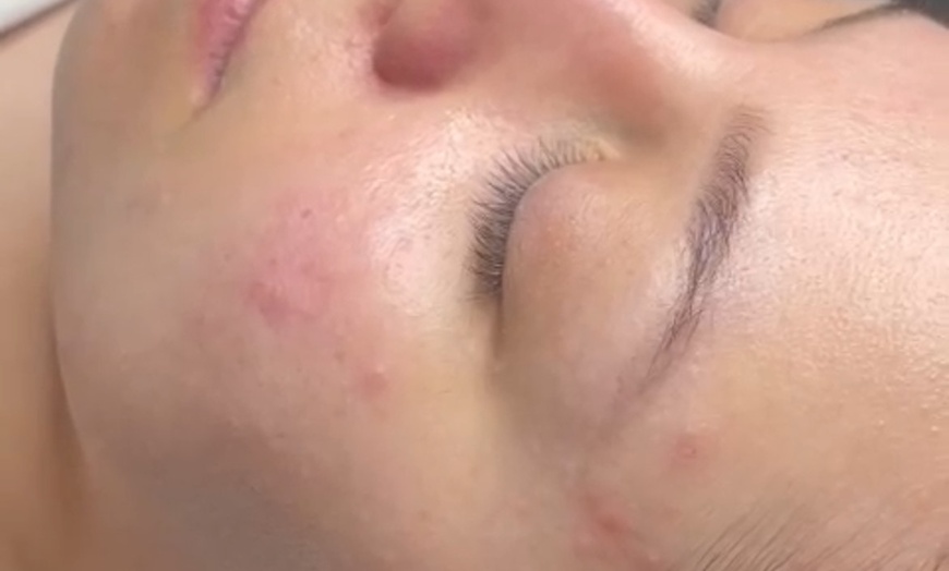 Image 3: Indulge in One or Two 60-Minute Facials with Choice of Add-On