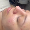 Image 3: Indulge in One or Two 60-Minute Facials with Choice of Add-On