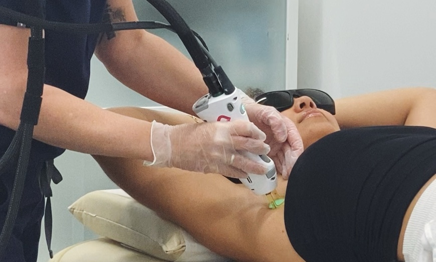 Image 6: Get Laser Hair Removal for Bikini, Brazilian, Legs, Neck & More