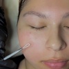 Image 4: Relax with One, Two, or Three 60-Minute HydraFacial Sessions