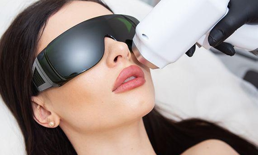 Image 7: Six Laser Hair-Removal Treatments for Every Area Size