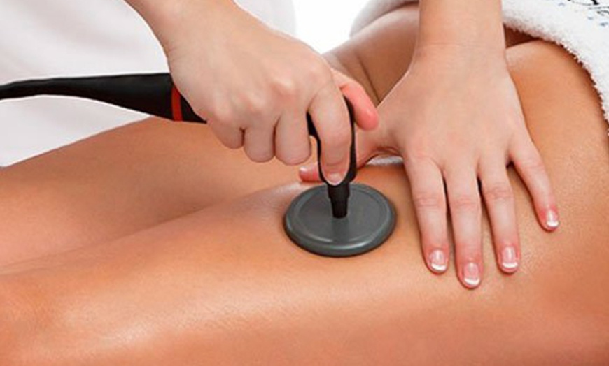 Image 13: 1, 2 o 4 sesiones de radiofrecuencia facial