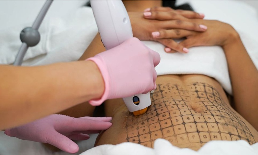 Image 2: THERMAGE with Bonus Bio Collagen Mask and Cryo Cooling Treatment 
