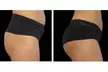 Get EMS Sculpt Abs/Buttocks/Thighs in Just 30 Minutes at Harmony In Health (Up to 74% Off) - Second Medium