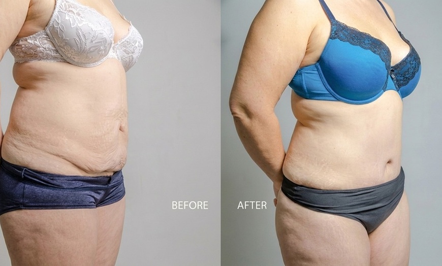 Image 14: Body Contouring with Red Light & Vibration Therapy