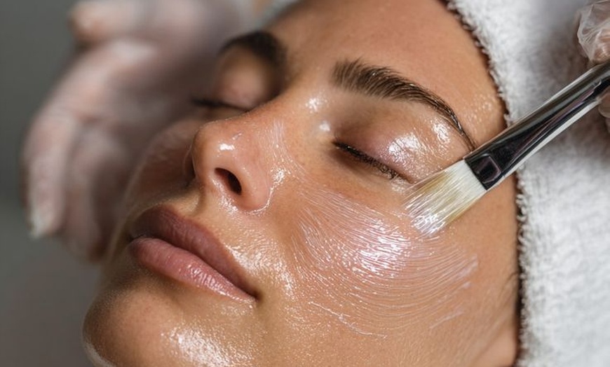 Image 4: Classic Glow Microneedling with LL Light Therapy & MediMD Serum