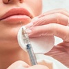 Image 1: Get 20, 40 or 60 Units of Botox
