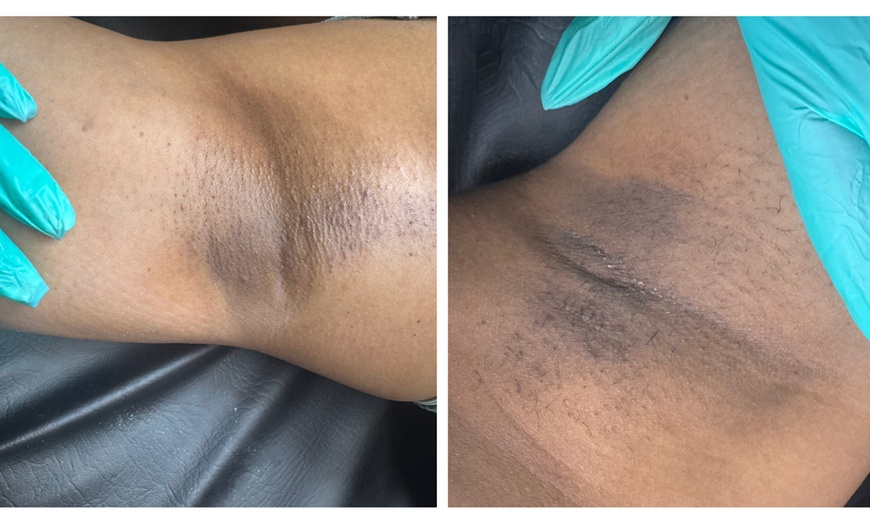 Image 2: One or Three Men's or Women’s Brazilian Waxes