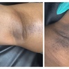 Image 2: One or Three Men's or Women’s Brazilian Waxes