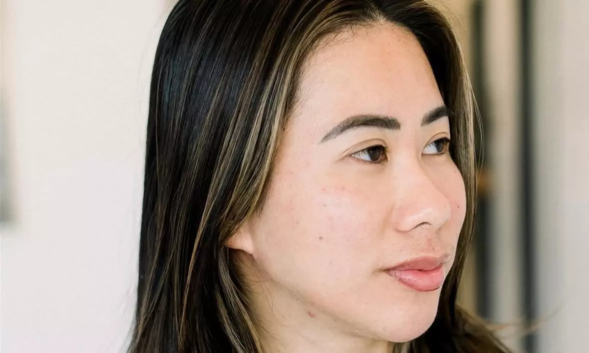 Up to 34% Off on Injection - Botox at K-Glo Aesthetics