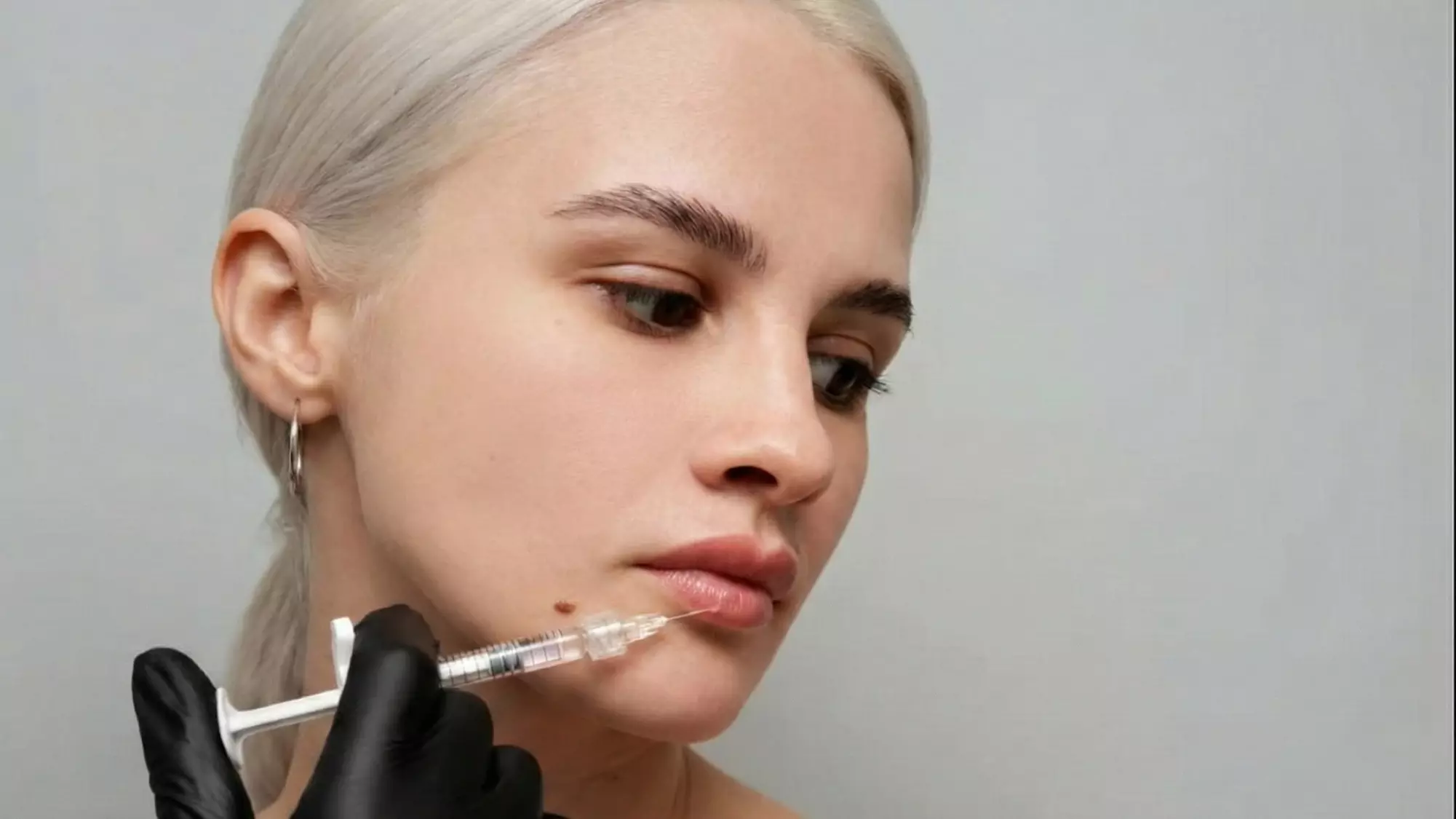 Precision Xeomin Treatments for a Natural, Refreshed Look