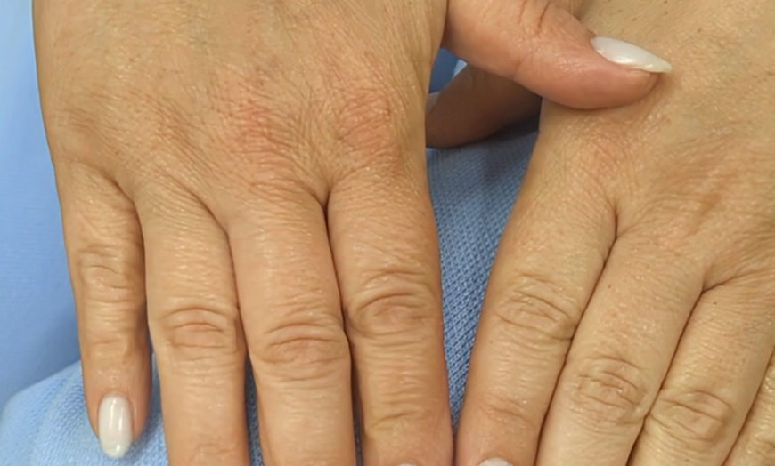 Image 7: Transform Your Nails with Gel Manicure at Beauté and Browź Clinic (Up to 56% Off)