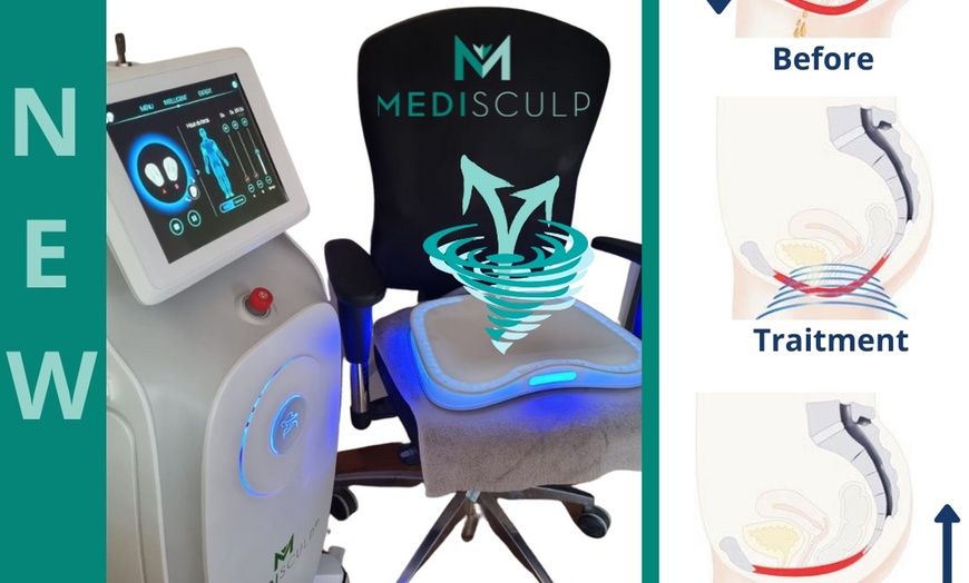 Image 3: EMSculpt (EMS Medisculp) at Cryojuvenate