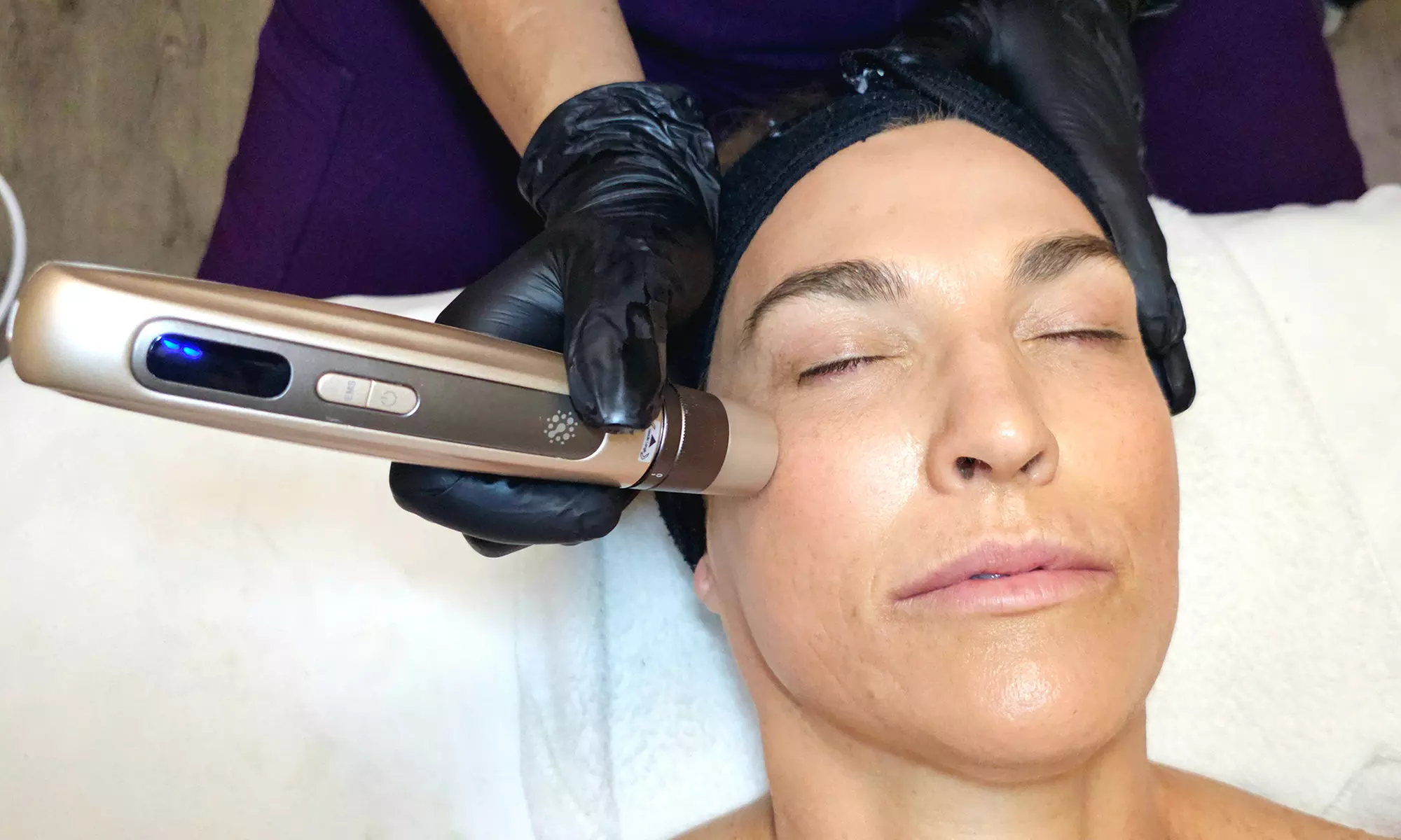 Radiant Skin Transform w/ Microcurrent Microneedling + BB Glow Add-On!