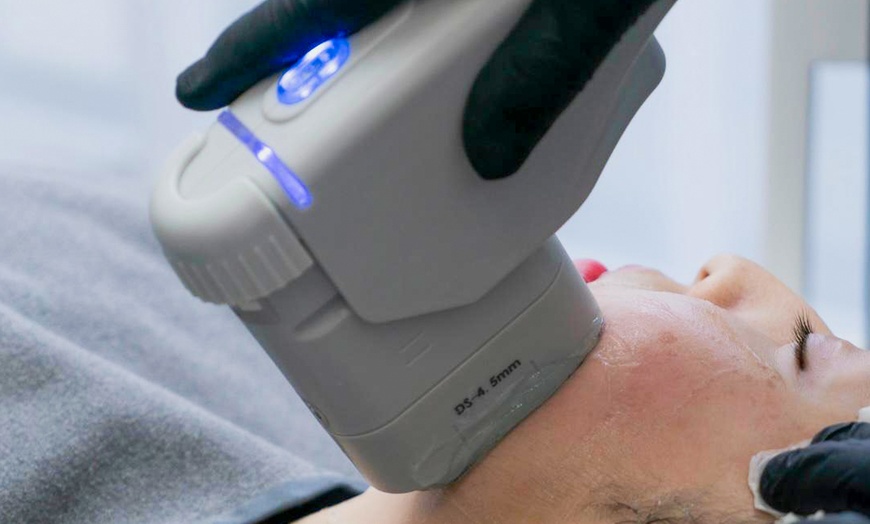 Image 1: Transform Your Look with a Double Chin Reduction Treatment