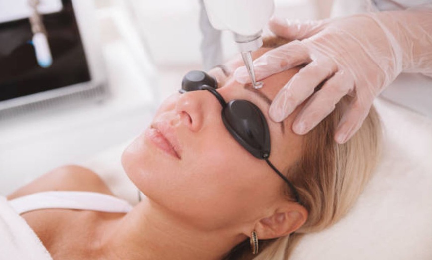 Image 11: 5 o 10 sesiones de eliminación de tatuajes