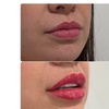 Image 7: Beauty in Balance - Botox at Rio MedSpa