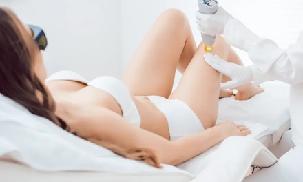 Für 1 kleine Zone: 3 Laser-Haarentfernungen für 1 Person - Elmera Kosmetik