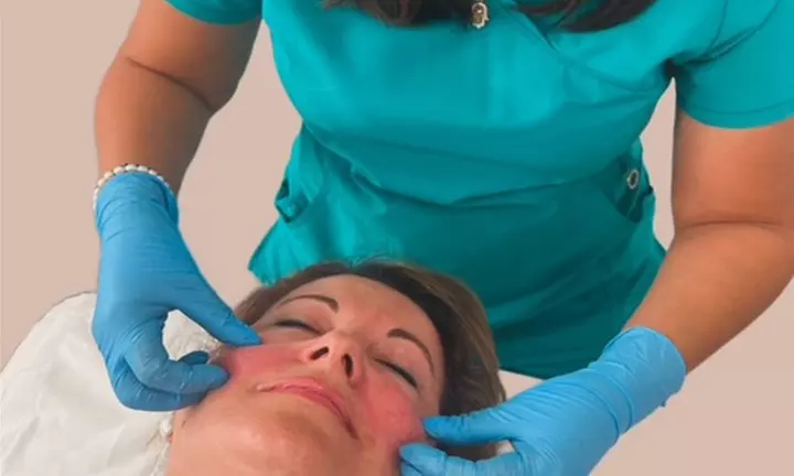 1 o 3 sesiones de rejuvenecimiento facial con IPL en Clinica Fresa 20