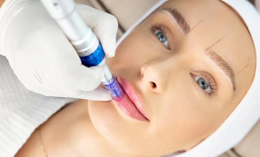 Image 1: Sesiones de rehidratación de labios, Dermapen facial y exosomas