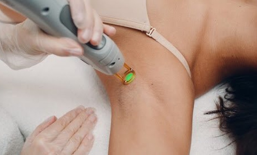 Image 5: Smooth, Hair-Free Skin with Laser Hair Removal Packages at GG Laser
