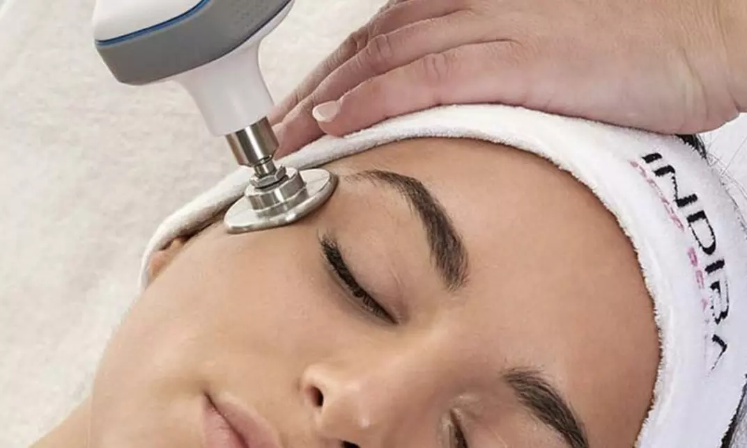 1, 2 o 3 sesiones de radiofrecuencia facial Indiba rostro completo