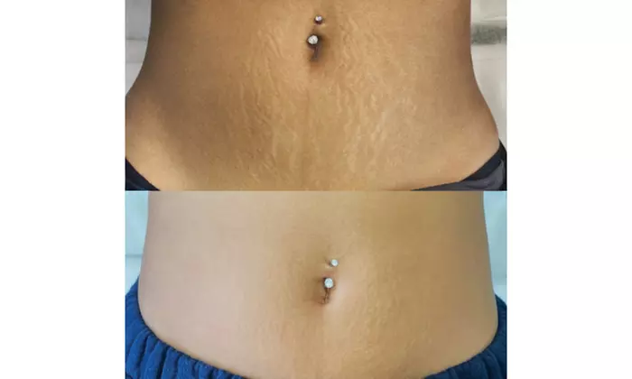 Up to 73% Off on Permanent Makeup at The Camo Clinic